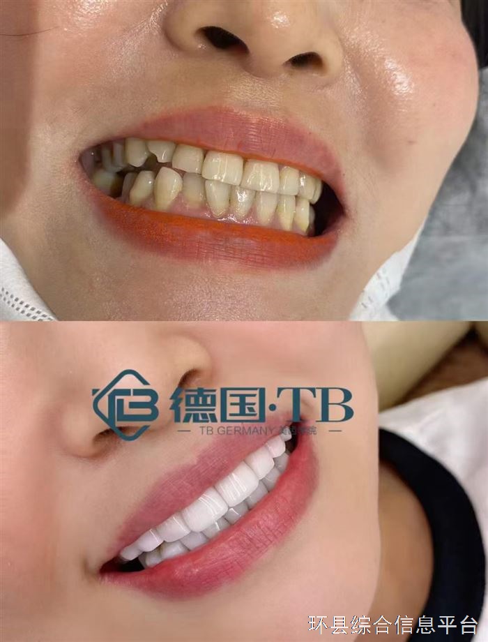特惠